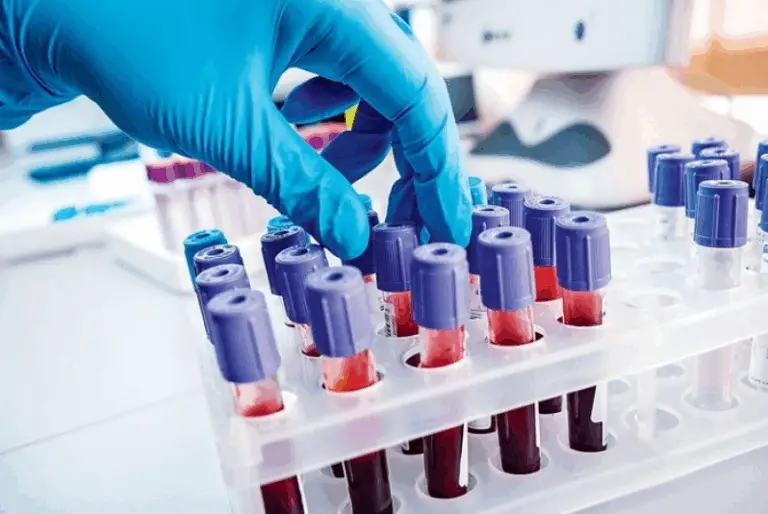 Funcionários de laboratórios da saúde de Belford Roxo seguem sem pagamento